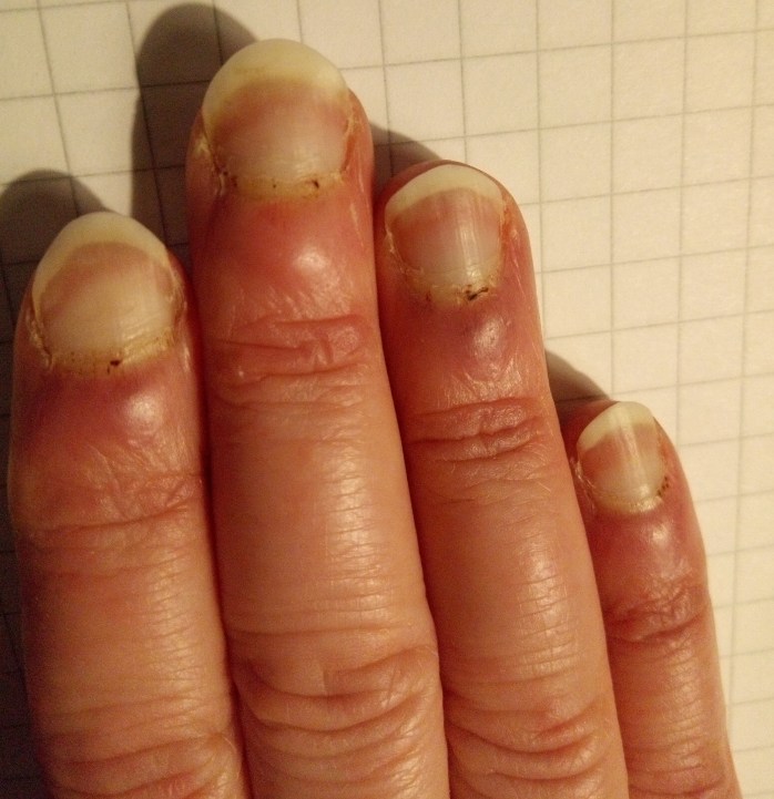 Tämän kuvan alt-attribuutti on tyhjä; Tiedoston nimi on mian-sormikuva-pyydettu-julkaisulupaa.jpg