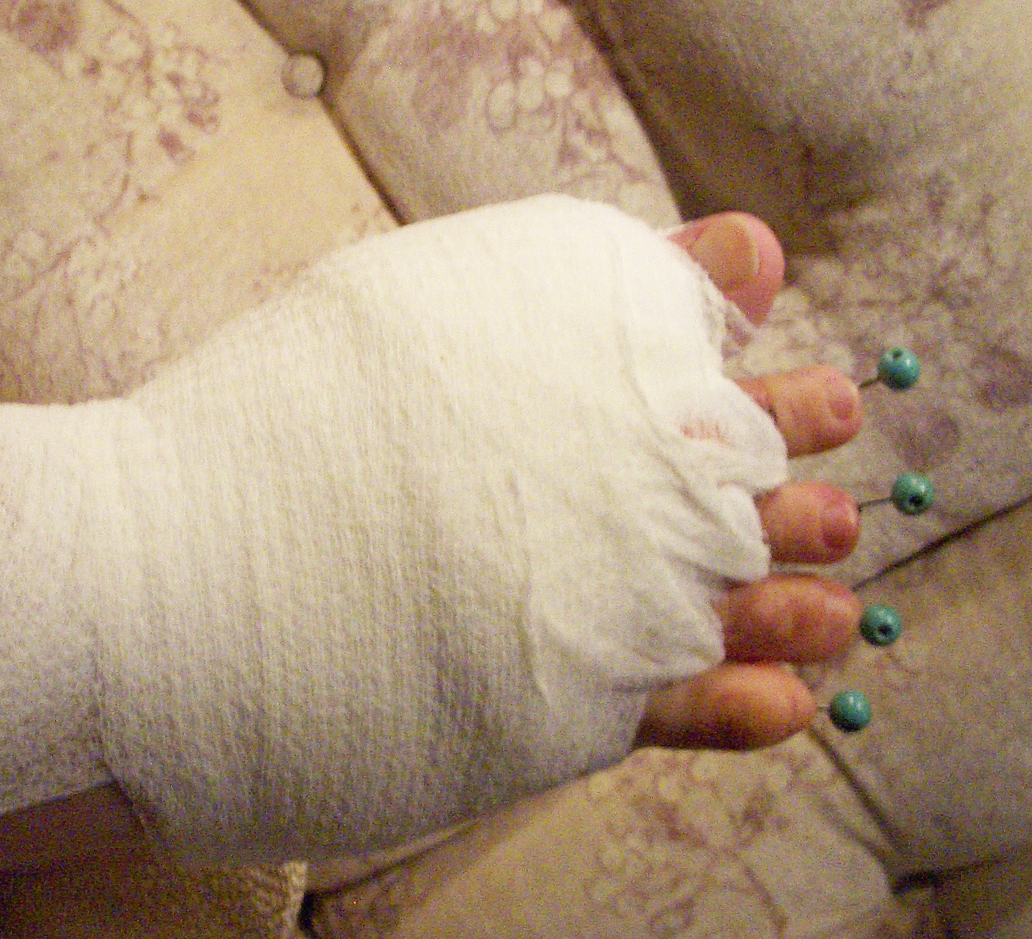 Toimenpiteen jälkeen